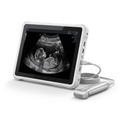 Acuity ScanSync Portable Diagnostic Ultrasound (Home Imaging) — hero view